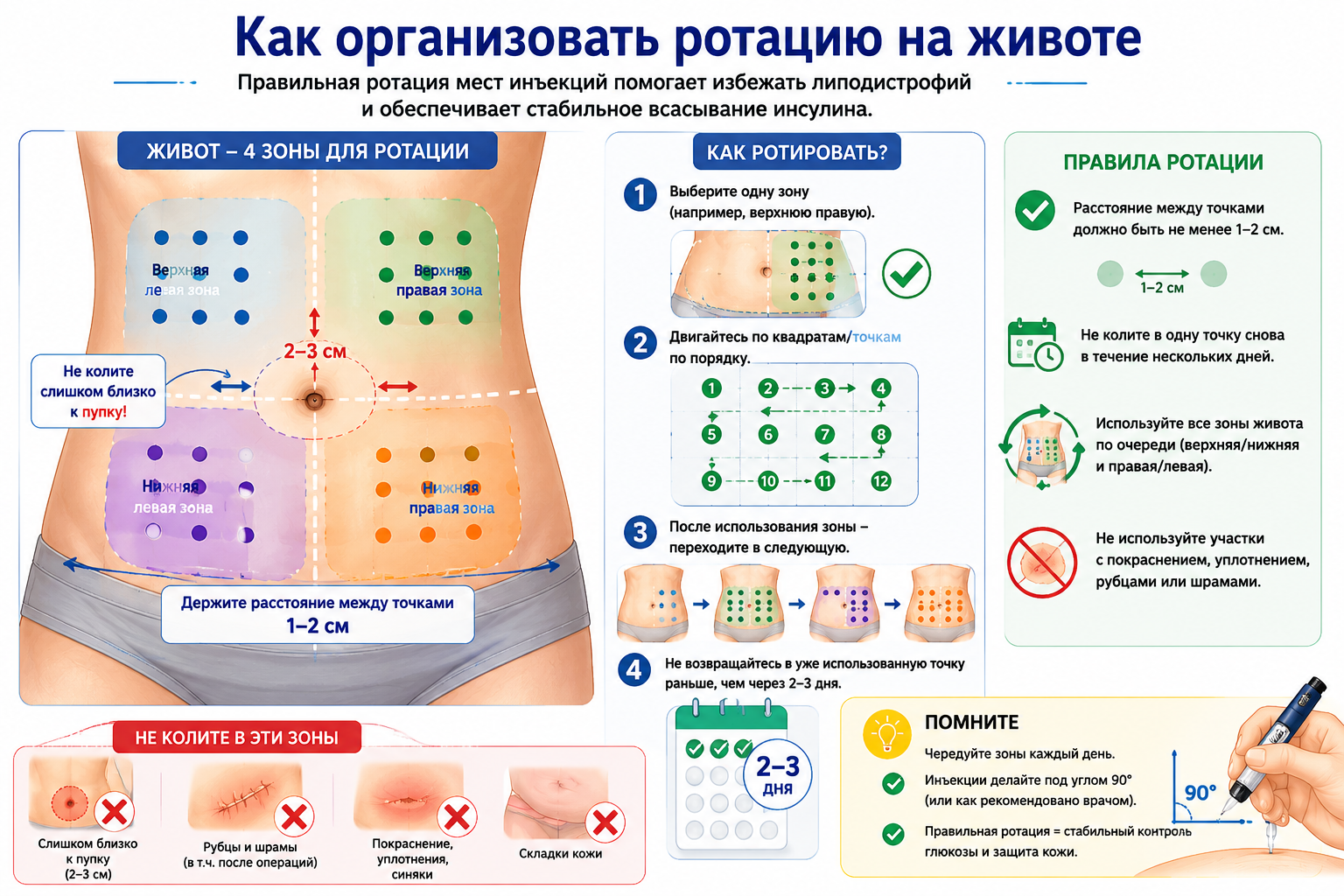 Пример понятной ротации точек инъекций на животе.